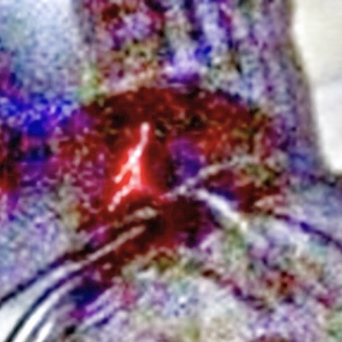 HDR-enhanced version of the same game-image area, shown as an examination aid